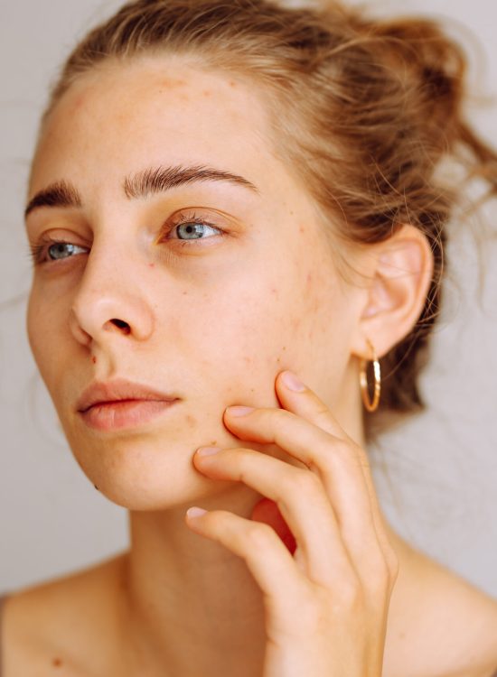 A young woman inspects her skin in natural light, focusing on blemishes while considering her skincare regimen. Dermatology, cosmetology, skin care. Natural skin.