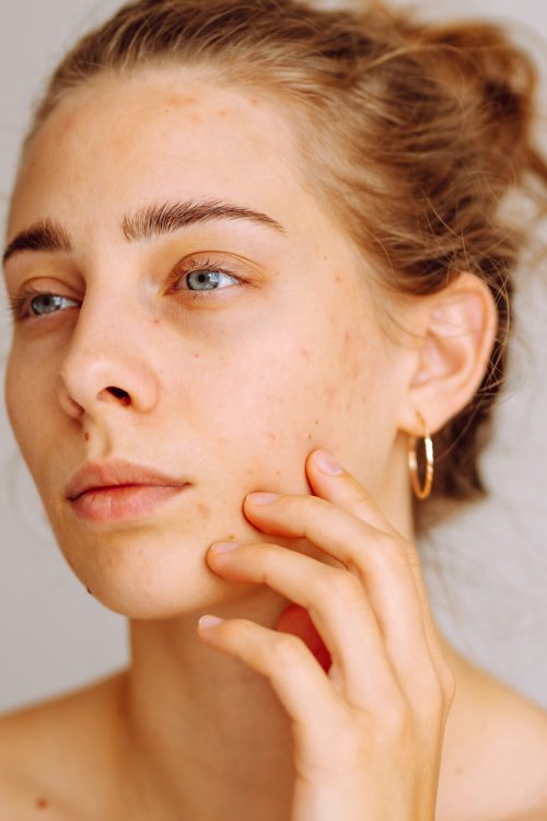 A young woman inspects her skin in natural light, focusing on blemishes while considering her skincare regimen. Dermatology, cosmetology, skin care. Natural skin.